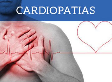 cardiopatia cardiopatia