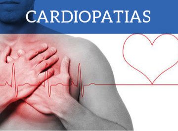 cardiopatia