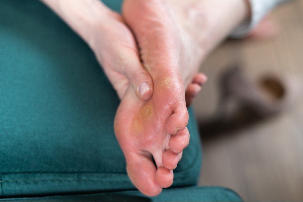 Pacientes diabéticos precisam cuidar dos pés para evitar complicações.